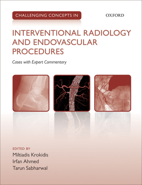 Cover image for book Challenging Concepts in Interventional Radiology