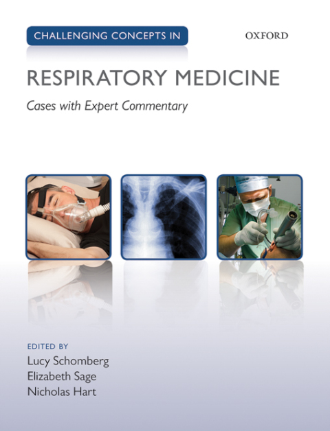 Cover image for book Challenging Concepts in Respiratory Medicine