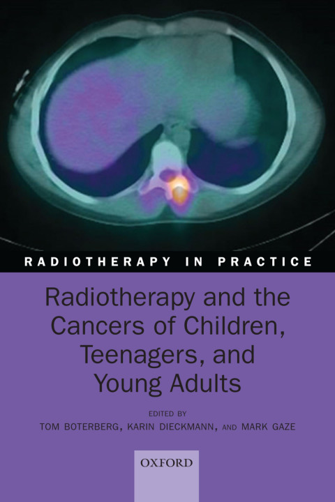 Cover image for book Radiotherapy and the Cancers of Children, Teenagers, and Young Adults
