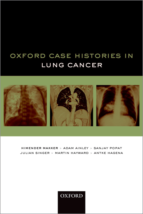 Cover image for book Oxford Case Histories in Lung Cancer