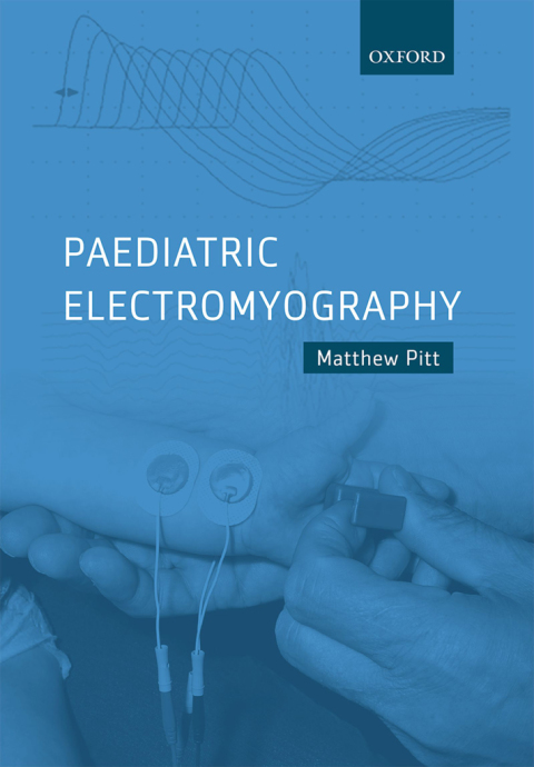 Cover image for book Paediatric Electromyography