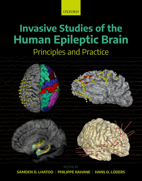 Cover image for book Invasive Studies of the Human Epileptic Brain