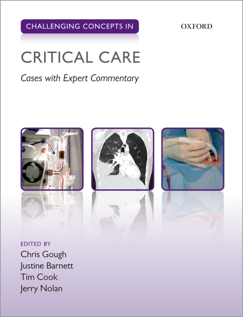 Cover image for book Challenging Concepts in Critical Care