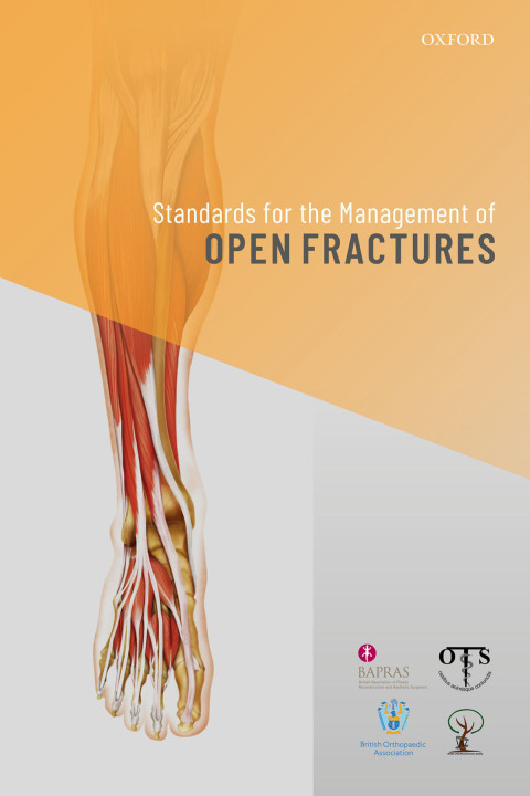 Cover image for book Standards for the Management of Open Fractures