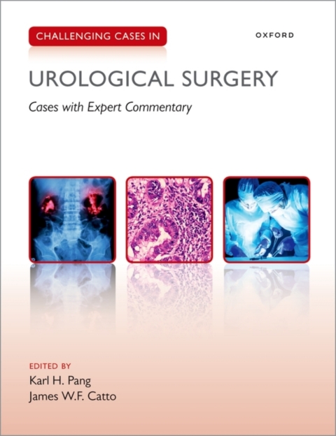 Cover image for book Challenging Cases in Urological Surgery