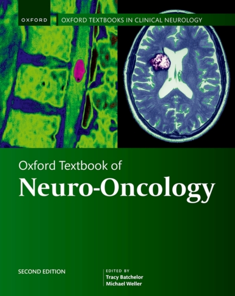 Cover image for book Oxford Textbook of Neuro-Oncology