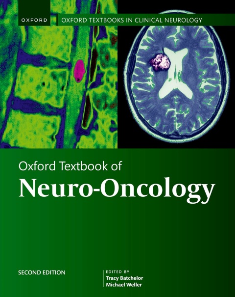 Cover image for book Oxford Textbook of Neuro-Oncology