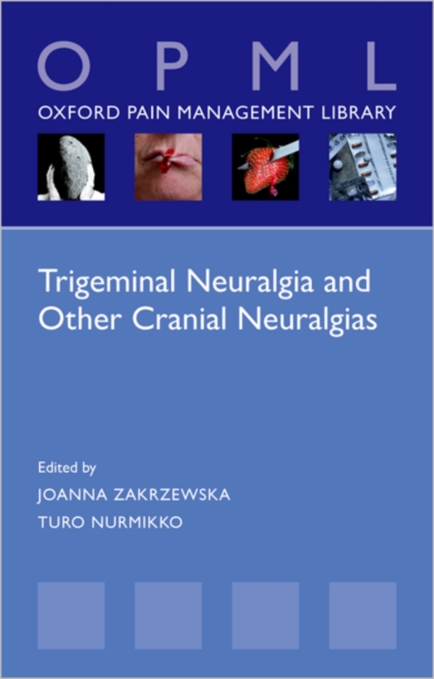 Cover image for book Trigeminal Neuralgia and Other Cranial Neuralgias