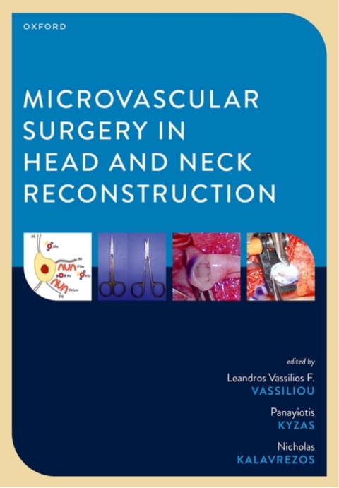 Cover image for book Microvascular Surgery in Head and Neck Reconstruction