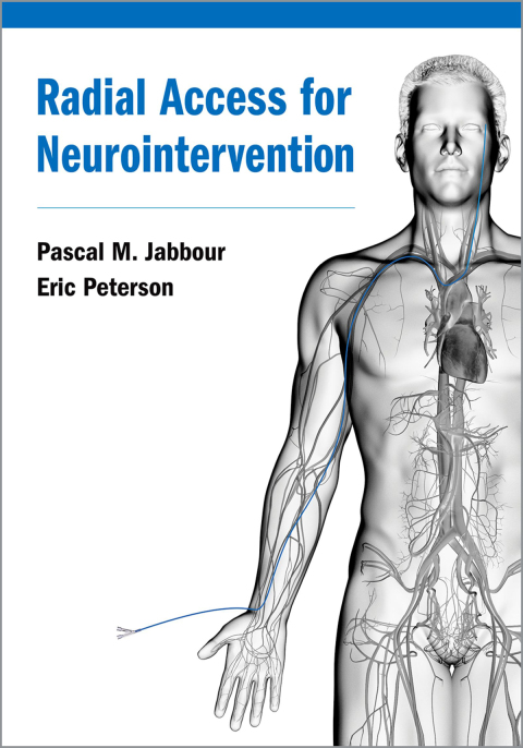 Cover image for book Radial Access for Neurointervention