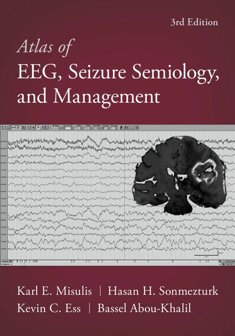 Cover image for book Atlas of EEG, Seizure Semiology, and Management