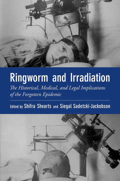 Cover image for book Ringworm and Irradiation