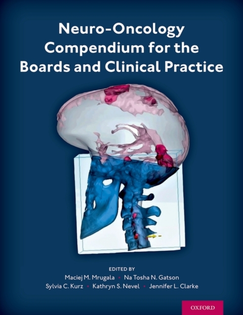 Cover image for book Neuro-Oncology Compendium for the Boards and Clinical Practice