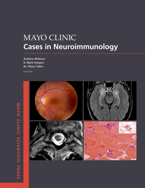 Cover image for book Mayo Clinic Cases in Neuroimmunology