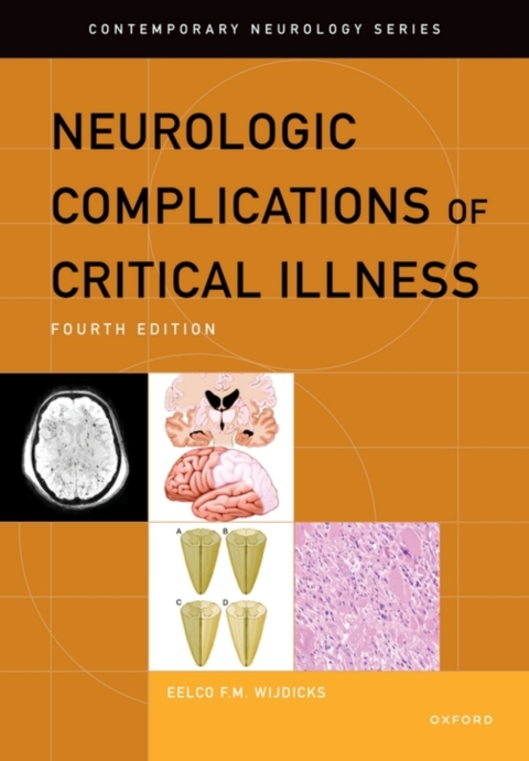 Cover image for book Neurologic Complications of Critical Illness