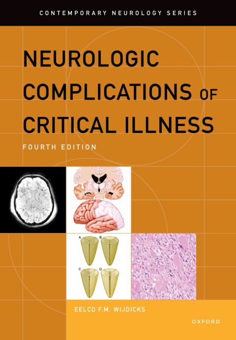 Cover image for book Neurologic Complications of Critical Illness