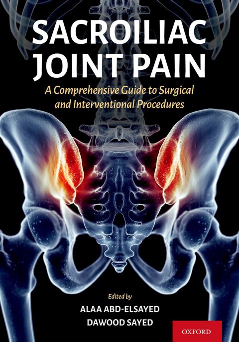 Cover image for book Sacroiliac Joint Pain