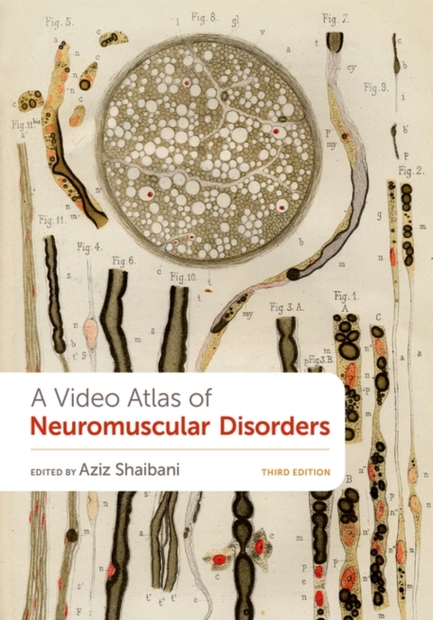 Cover image for book A Video Atlas of Neuromuscular Disorders