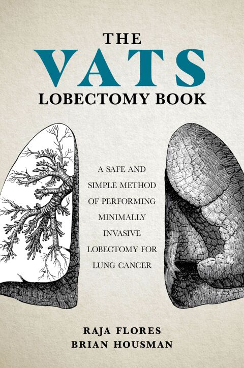 Cover image for book The VATS Lobectomy Book