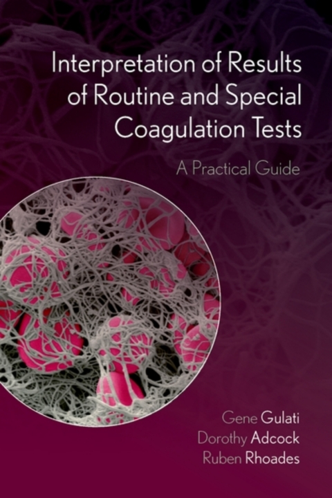Cover image for book Interpretation of Results of Routine and Special Coagulation Tests