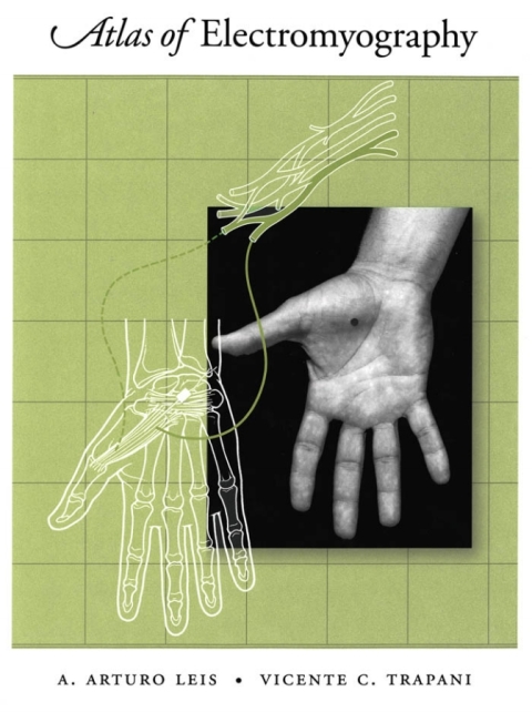 Cover image for book Atlas of Electromyography