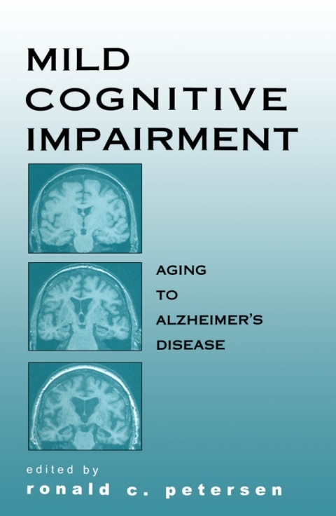 Cover image for book Mild Cognitive Impairment