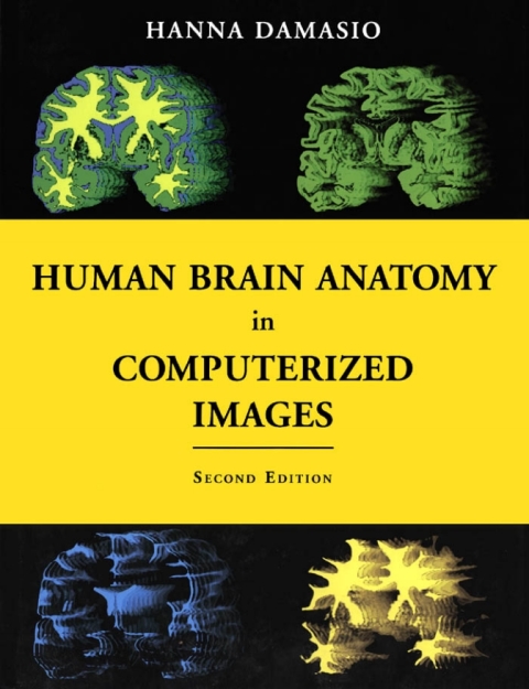 Cover image for book Human Brain Anatomy in Computerized Images