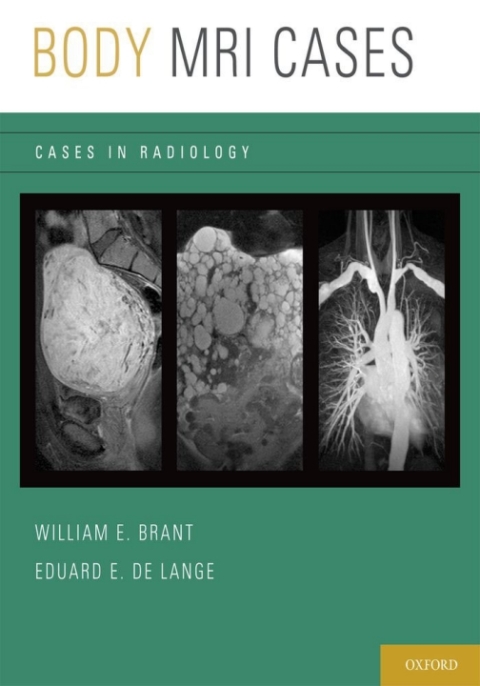 Cover image for book Body MRI Cases