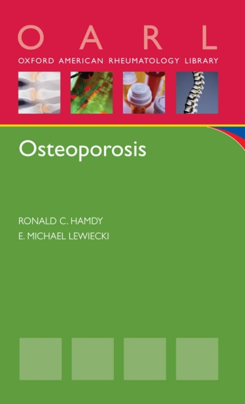 Cover image for book Osteoporosis