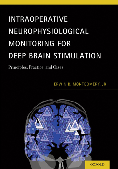 Cover image for book Intraoperative Neurophysiological Monitoring for Deep Brain Stimulation