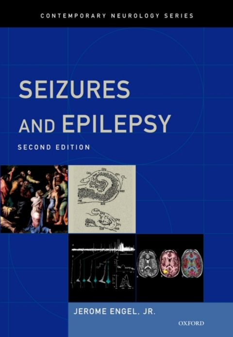 Cover image for book Seizures and Epilepsy