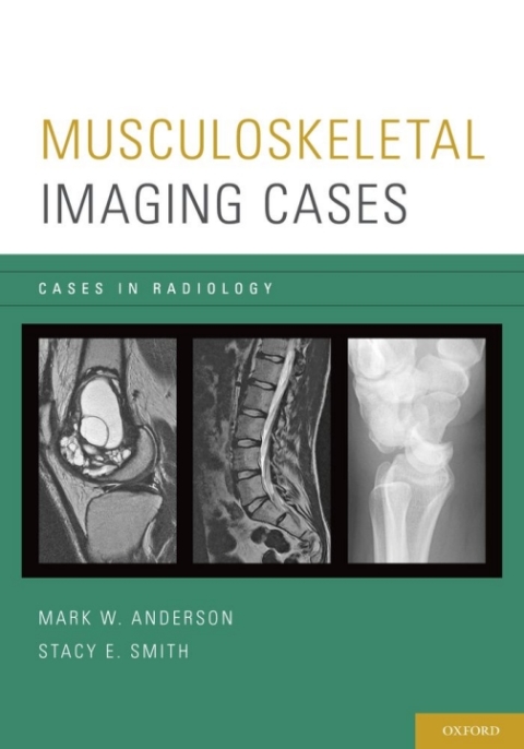 Cover image for book Musculoskeletal Imaging Cases