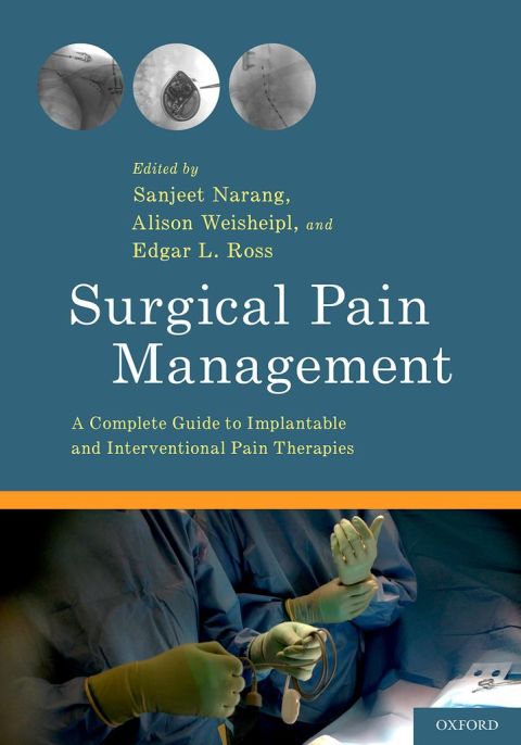 Cover image for book Surgical Pain Management