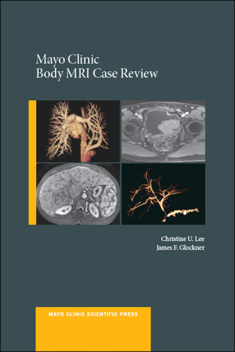 Cover image for book Mayo Clinic Body MRI Case Review