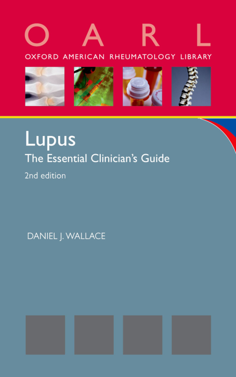 Cover image for book Lupus