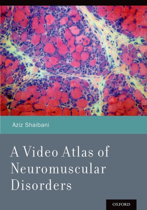 Cover image for book A Video Atlas of Neuromuscular Disorders