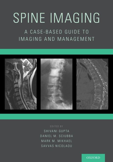 Cover image for book Spine Imaging