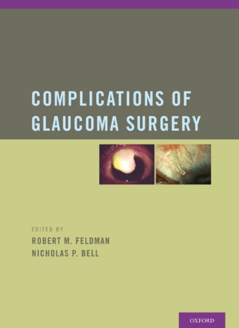 Cover image for book Complications of Glaucoma Surgery