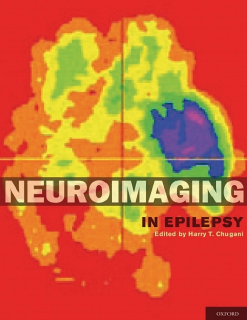 Cover image for book Neuroimaging in Epilepsy