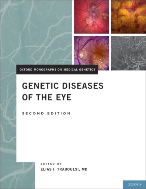 Cover image for book Genetic Diseases of the Eye