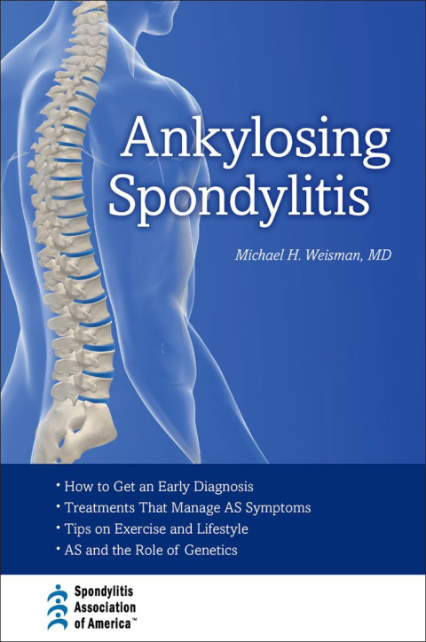 Cover image for book Ankylosing Spondylitis