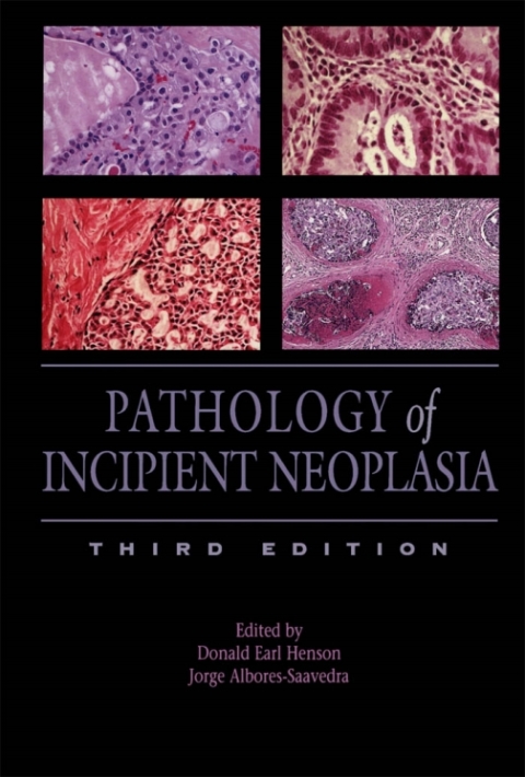 Cover image for book Pathology of Incipient Neoplasia