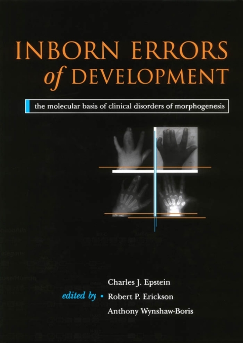 Cover image for book Inborn Errors of Development