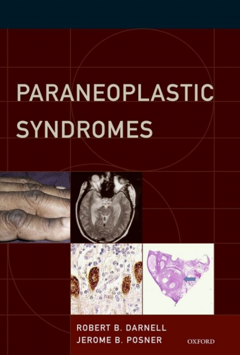 Cover image for book Paraneoplastic Syndromes