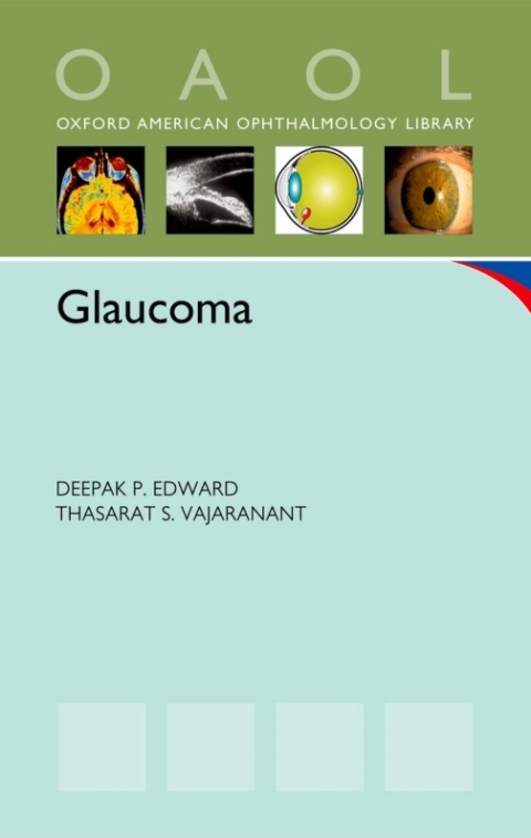 Cover image for book Glaucoma