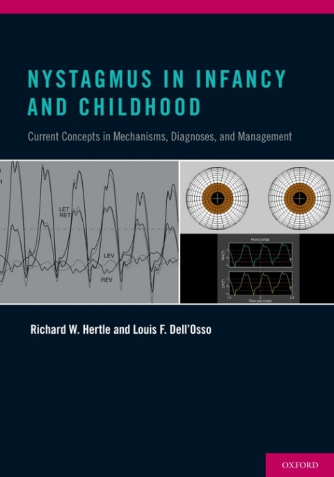 Cover image for book Nystagmus In Infancy and Childhood