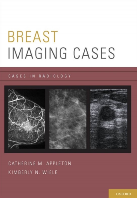 Cover image for book Breast Imaging Cases