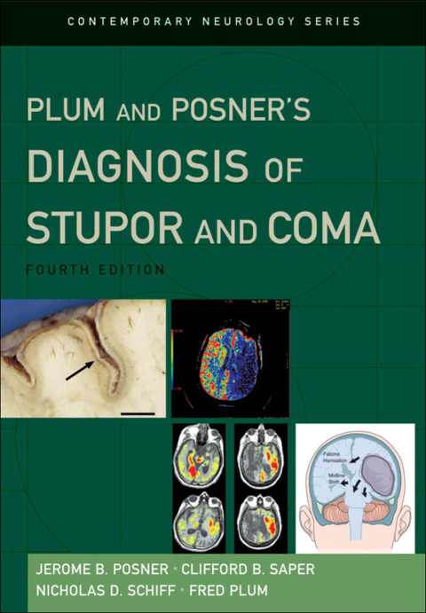 Cover image for book Plum and Posner's Diagnosis of Stupor and Coma