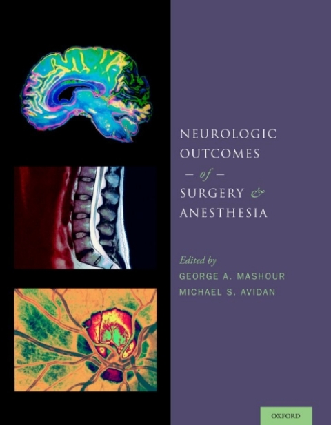 Cover image for book Neurologic Outcomes of Surgery and Anesthesia