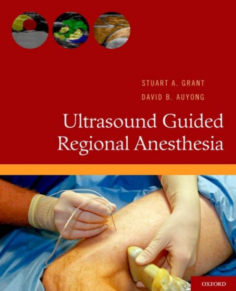 Cover image for book Ultrasound Guided Regional Anesthesia
